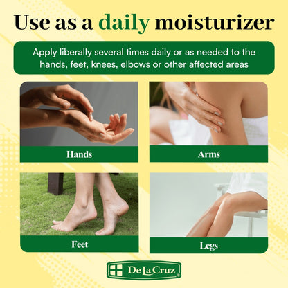 De La Cruz Arnica Salve Moisturizer for Cracked Skin, for Dry and Cracked Hands, Elbows and Feet, 2 oz Jar