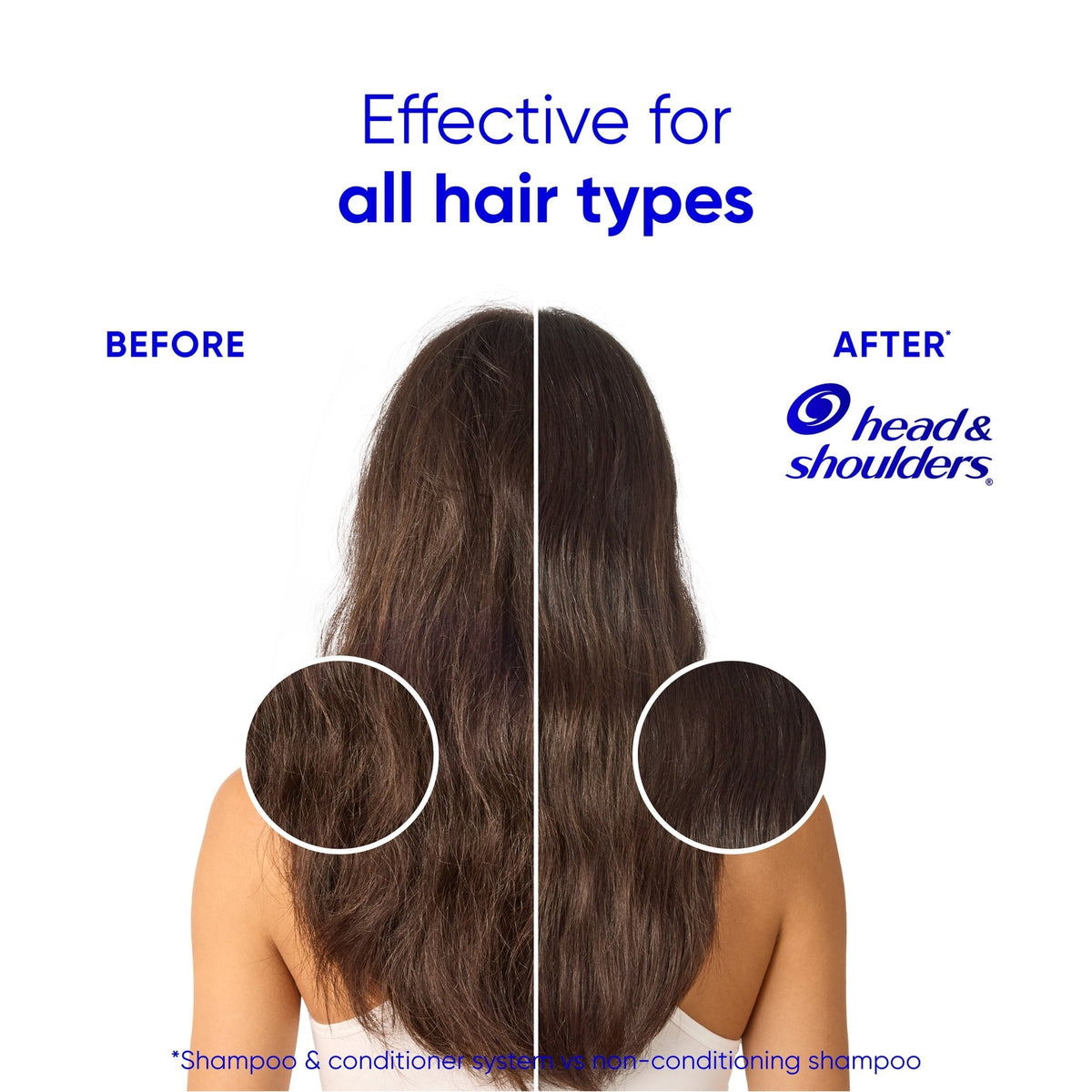 (6 pack) Head and Shoulders Coconut Dandruff Shampoo, Hydrating, Lightweight Moisture, Color Safe, 12.5 fl oz
