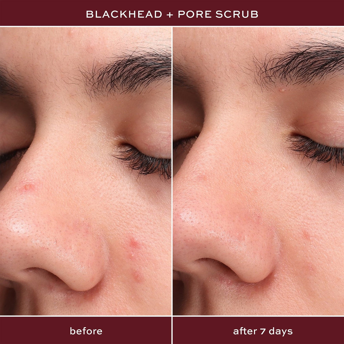 ITK Skincare Blackhead and Pore Scrub Exfoliating, Skincare Treatment with Salicylic Acid, 0.5fl oz